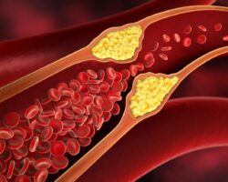 Cholesterol | Importance, Side Effects and other Facts